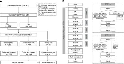 Application of Convolutional Neural Network in the Diagnosis of Cavernous Sinus Invasion in Pituitary Adenoma